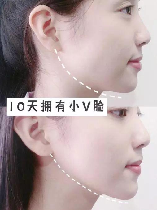 屈臣氏“断货王”面膜，一拉一提拥有小v脸，薇娅、宋祖儿都在用