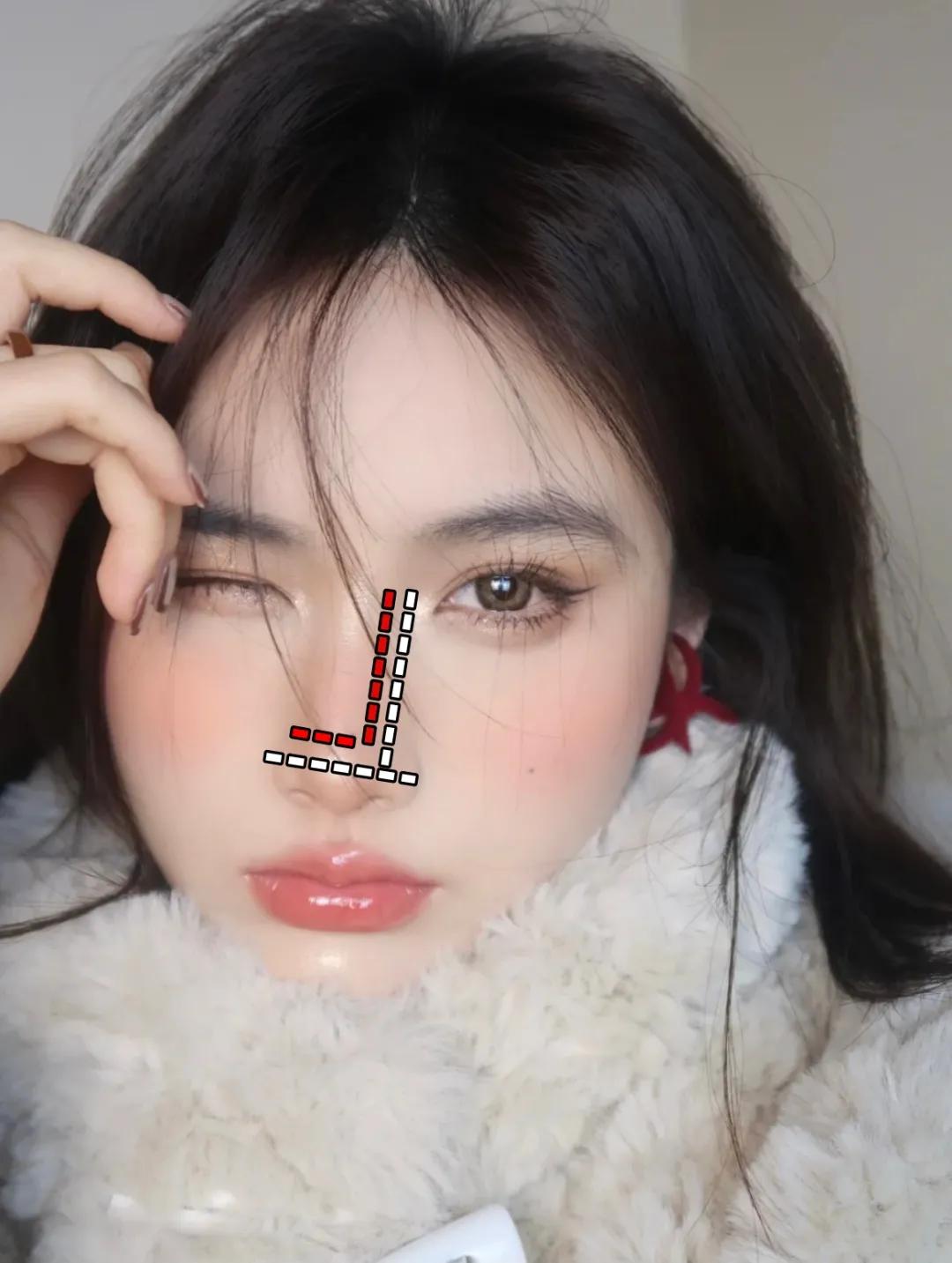 全脸点痣变美,点痣能变美吗