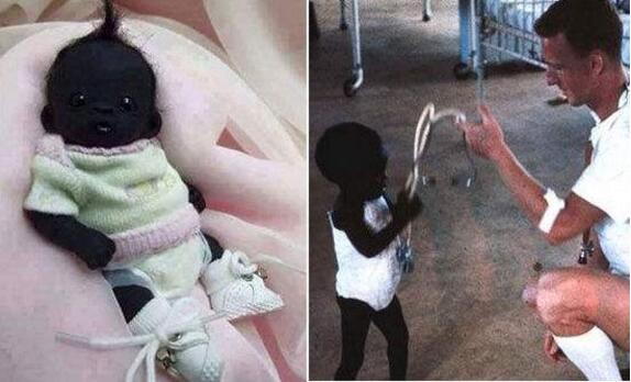 世界上皮肤最白的女孩,世界肤色最黑的人