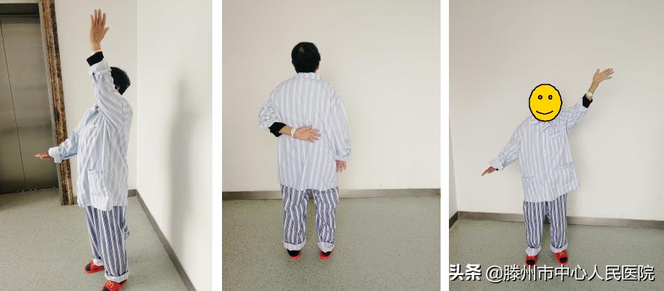 肩关节后脱位肩袖修补术,肩关节习惯性脱位修复手术评残