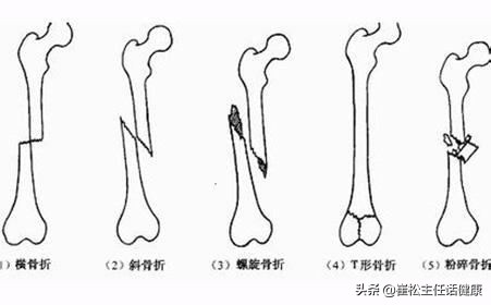 不想去医院第三弹！腹部不适的自我诊察