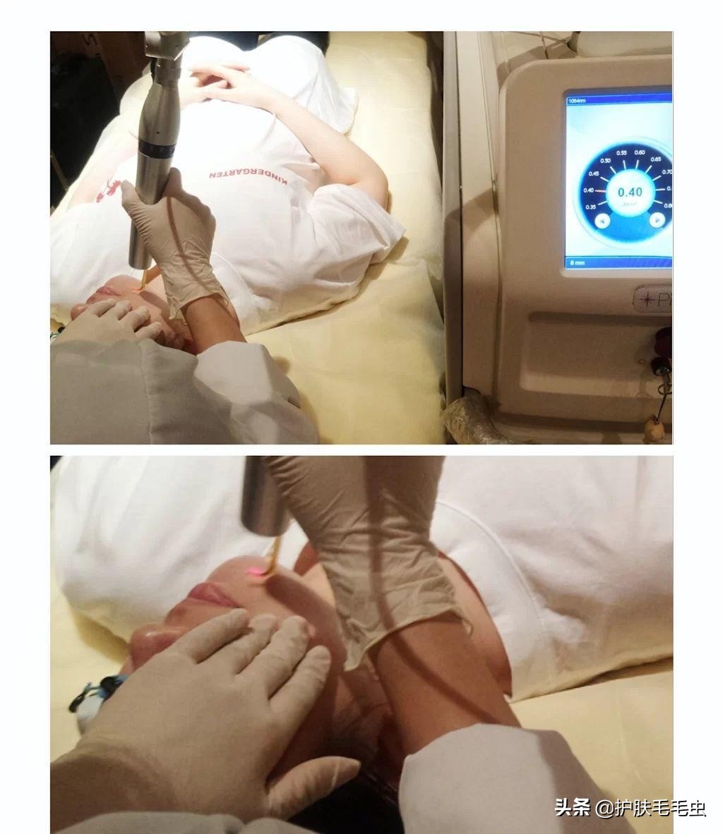 脸上长斑是什么原因怎样能调理好,什么原因导致脸上长斑要怎么治疗