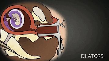 人流最多次案例,20岁女孩人流七次后续