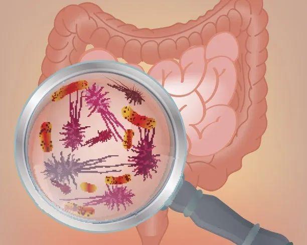 喝纯牛奶好还是纯奶粉好,喝纯牛奶好还是酸奶好