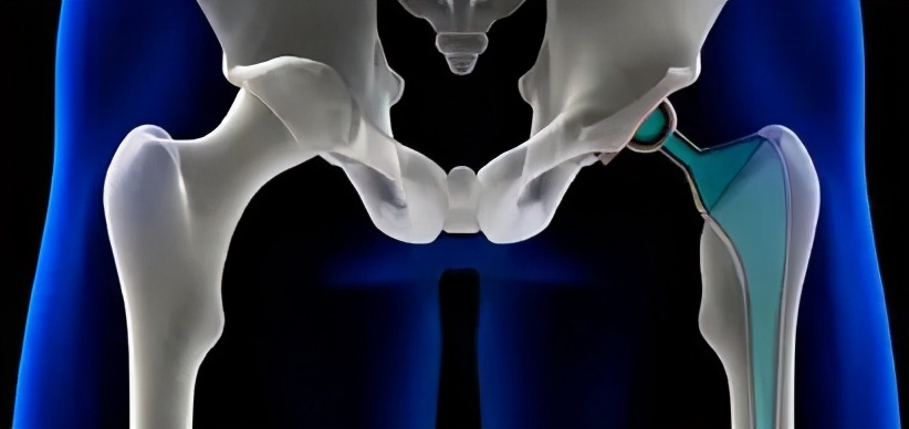 髋关节六方向练习|奇妙的内旋与外旋