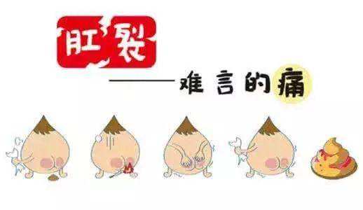 肛裂与痔疮容易混淆要警惕,肛裂加痔疮如何根治