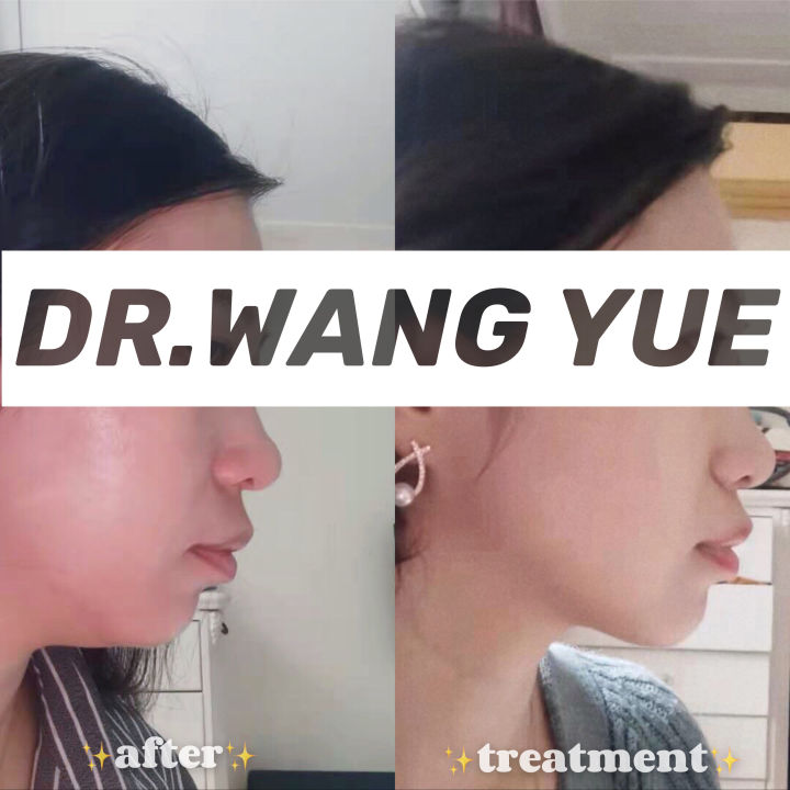 上海舌侧正畸医生,上海舌侧矫正哪家好