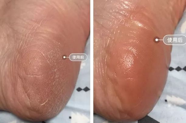 王子文拍照姿势,王子文惊艳泼辣写真