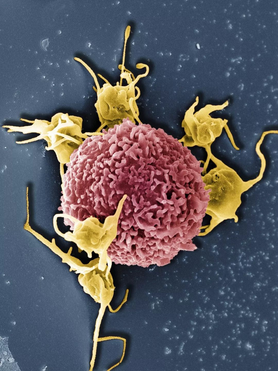 人体防卫战,人体痛点攻击技巧