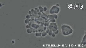 同样的癌症，一个活了一年，一个活了三十年，什么原因？