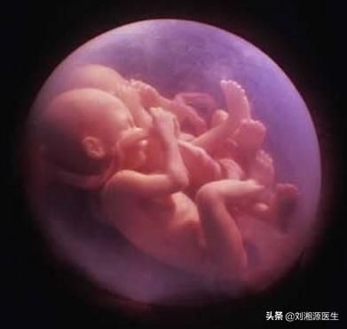 胎膜早破出血保胎成功案例,免疫问题会导致胎膜早破吗