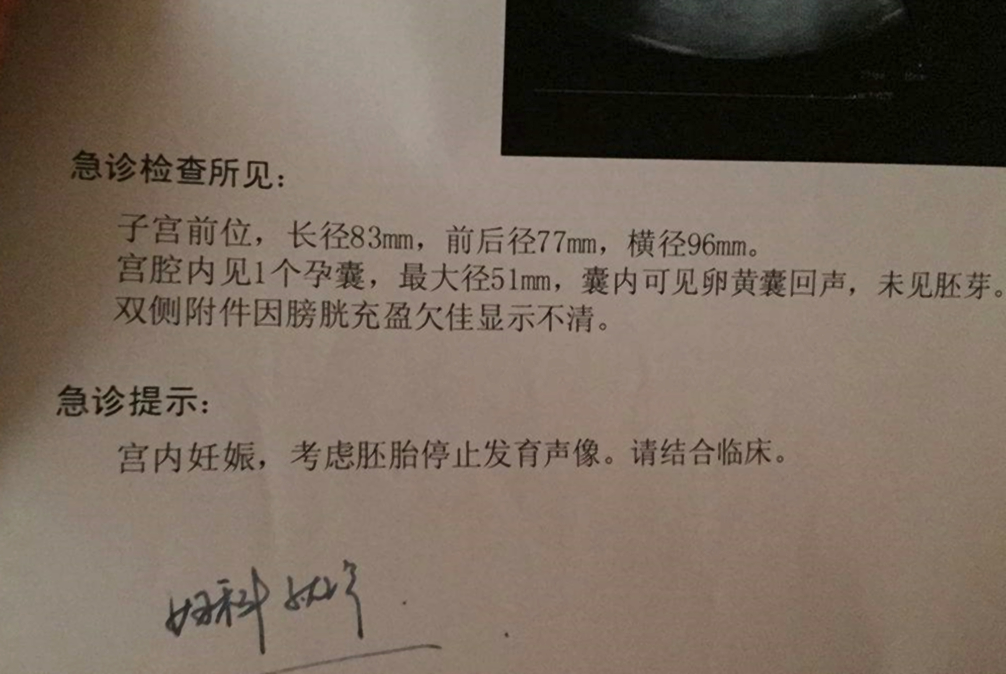 孕早期胎儿停育有什么反应,孕早期应该注意什么避免胎停育