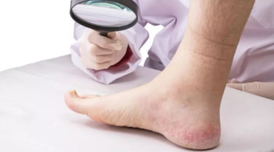 权健事件丁香园天价鞋垫被曝光,丁香园权健文章