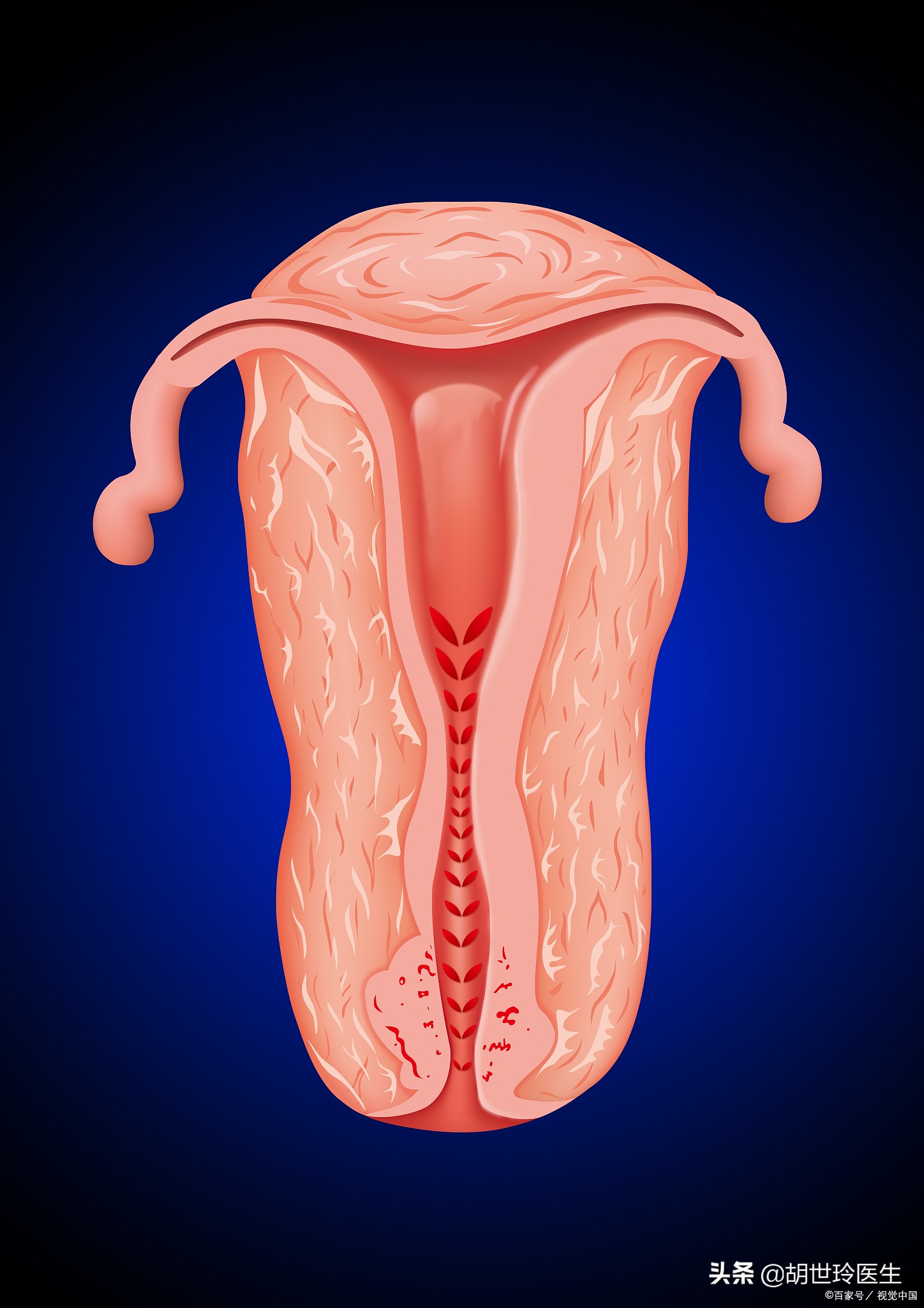 怎么自测有没有妇科病之类的,妇科病怎么检查才正确