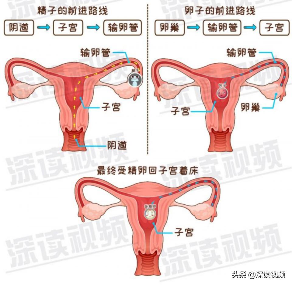 宫外孕出血量和月经一样怎么回事,宫外孕是怎么回事能不能再生孩子