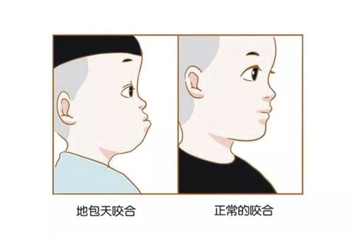 乳牙换恒牙不能不注意这些事,乳牙换恒牙期间要注意什么