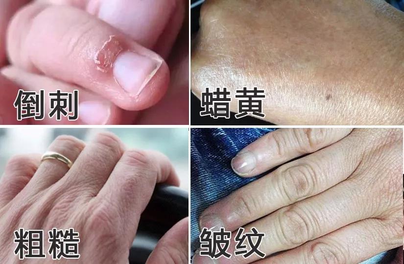 洗手液洗手真的很干净吗,正确洗手可以减少手部多少细菌