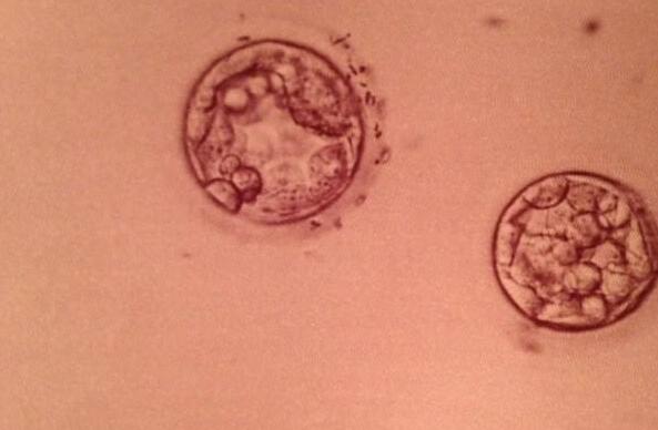 试管婴儿促排卵治疗综合评估,试管促排卵的十大问题