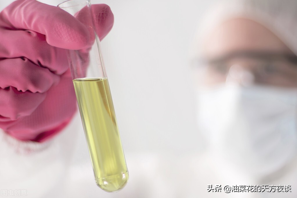 尿常规尿蛋白阴性啥意思,尿常规中尿蛋白说明什么