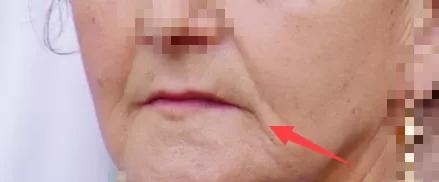 显老的八字纹,什么纹最显老又好看