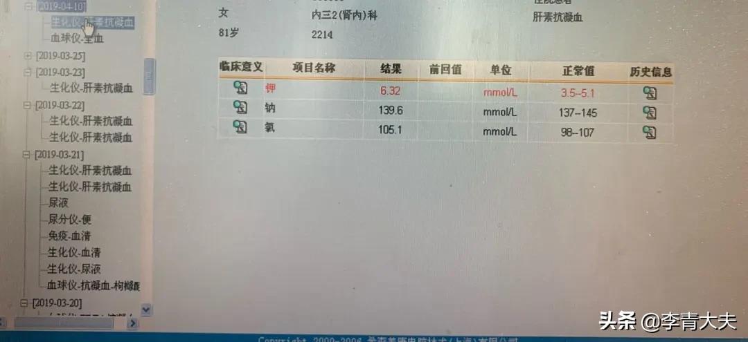 尿毒症患者血钾高的症状及危害,终末期肾病高钾血症