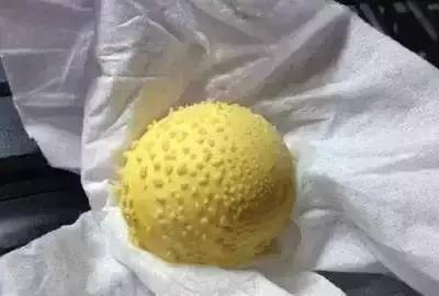 在身上滚鸡蛋就能祛除湿气,滚鸡蛋疗法能除湿气吗