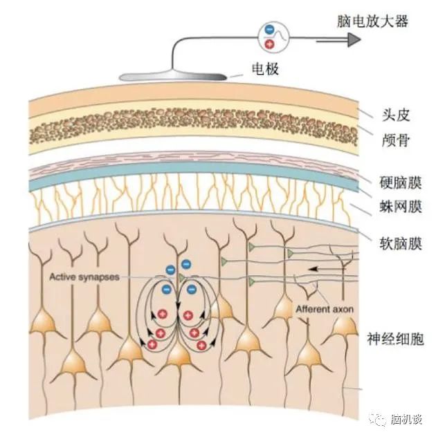 ​《脑机往事（3）—维达尔的秘密》