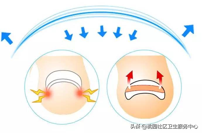 甲沟炎防治,甲沟炎怎么预防息肉