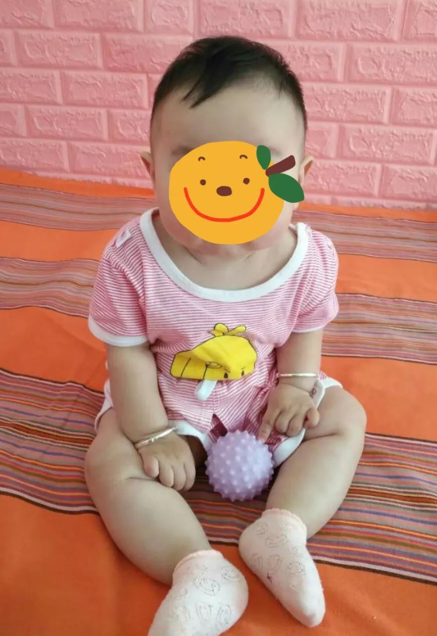 小儿肌性斜颈表现及治疗方案,婴儿肌性斜颈肿块多大算严重