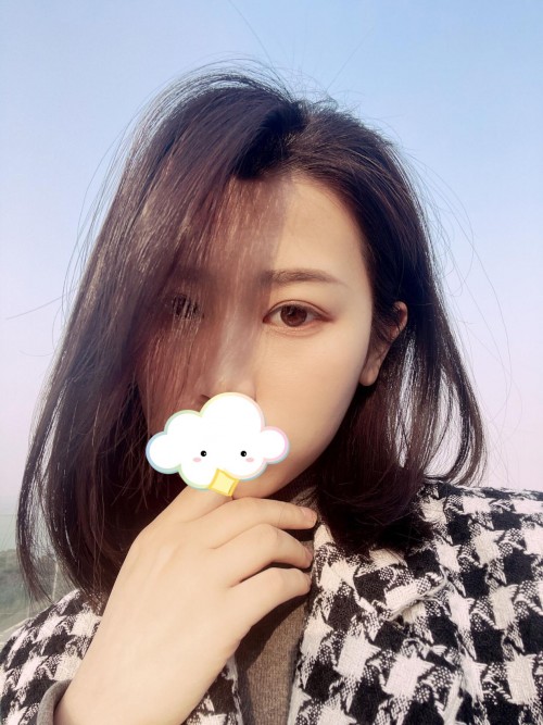 修志夫做双眼皮效果怎么样,修志夫双眼皮修复