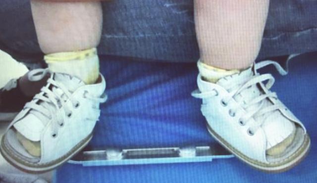 小孩出生脚内翻,宝宝出生脚有一个足内翻怎么办