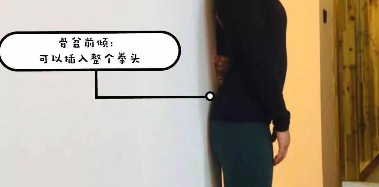 骨盆前倾引起的腰痛如何缓解,如何缓解久坐带来的腰酸腰痛