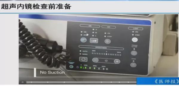 上消化道内镜检查常规流程图谱,消化内镜检查流程及注意事项