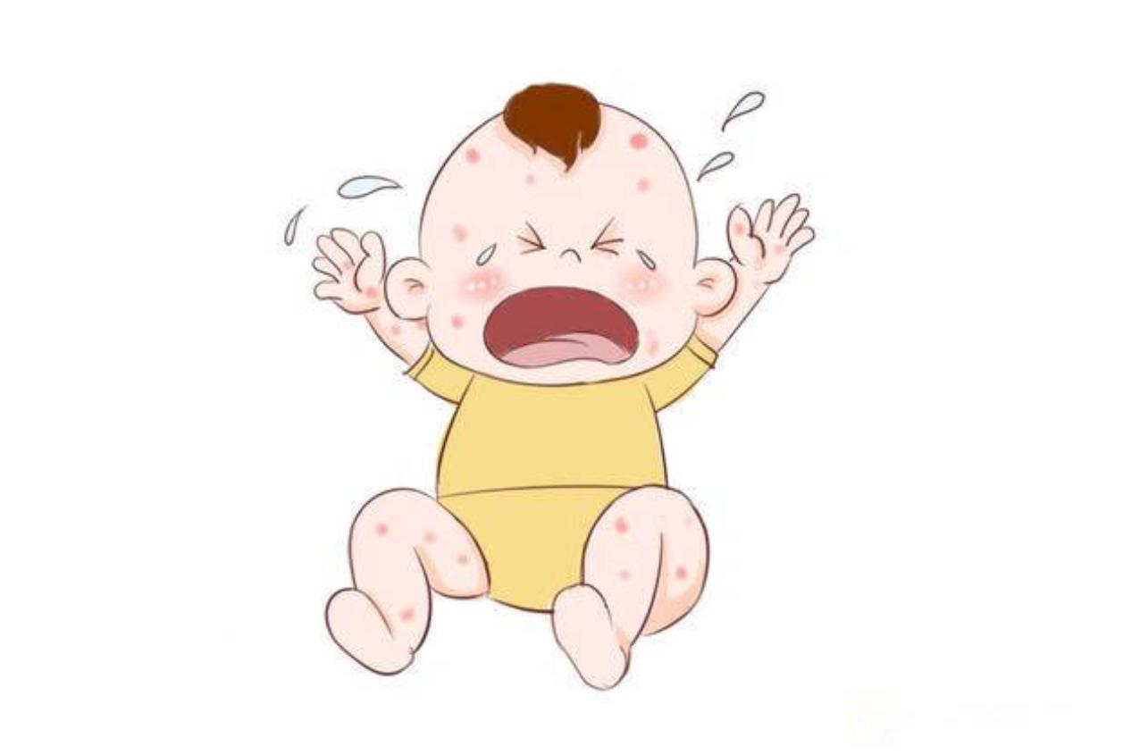 宝宝背后有疹子是什么疹子,宝宝出疹子会有什么疹子