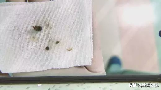 孩子鼻子塞进异物抠出来后流血,小孩被异物插进鼻子流血怎么办