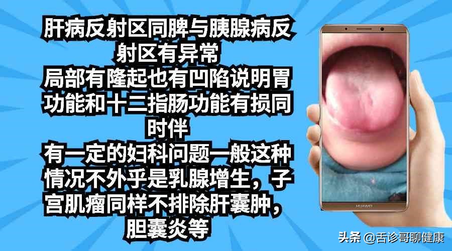 舌诊哥聊血瘀,抖音舌诊哥的感悟