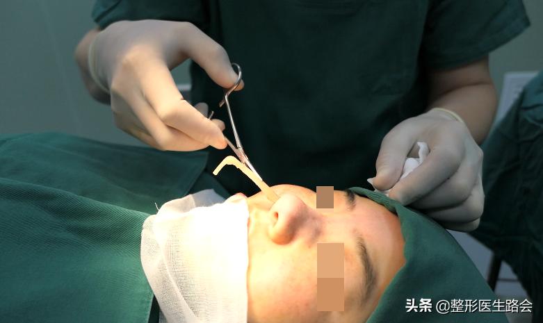 为什么耳软骨只能垫鼻尖不能隆鼻,肋软骨隆鼻时间久了会顶破鼻尖吗