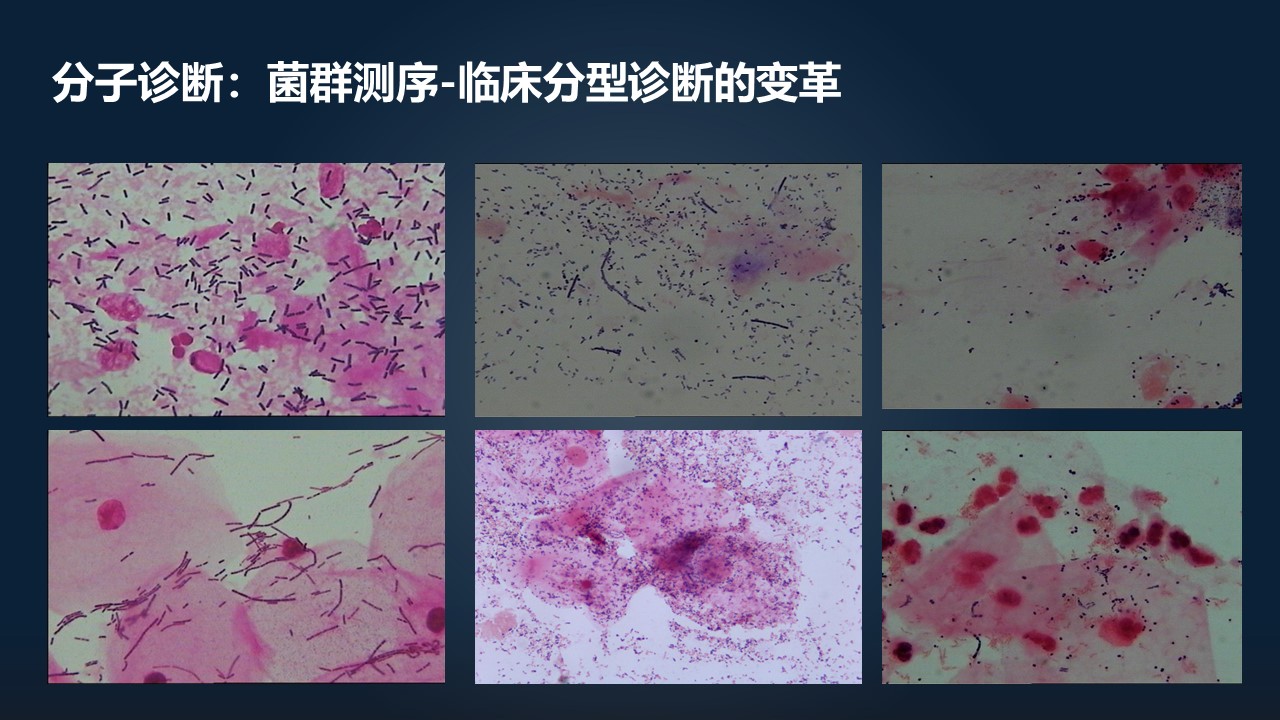 肖冰冰的小视频,肖冰冰讲的12生肖