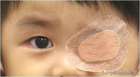 孩子戴上眼镜视力下降快怎么办,儿童左右眼视力相差100度怎么办