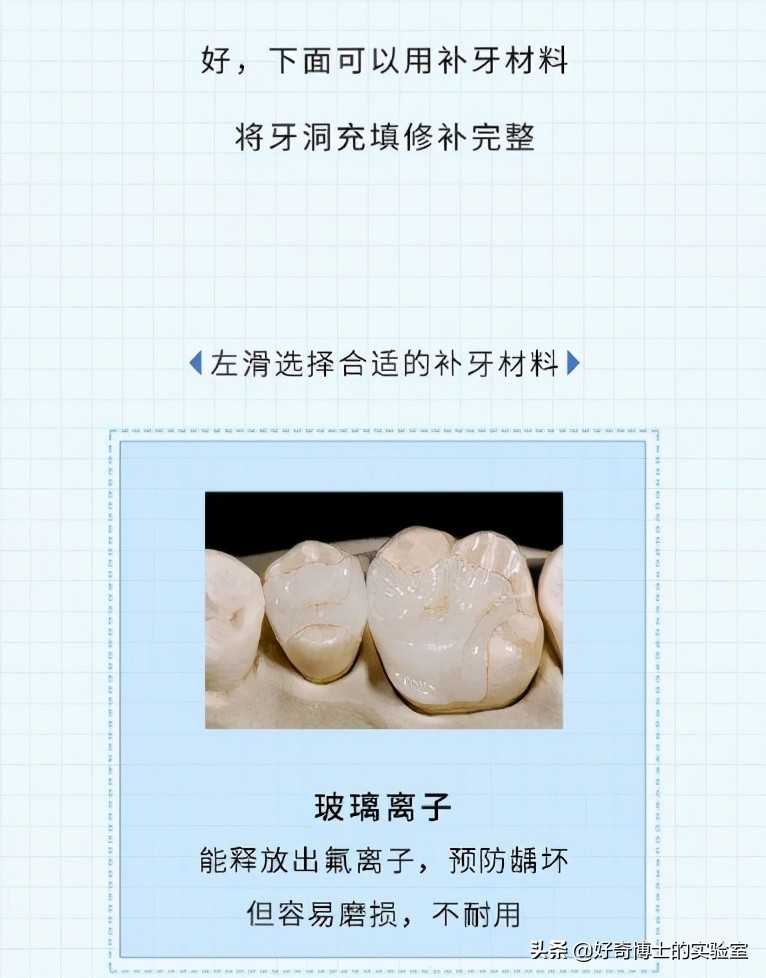 治牙到底有多恐怖,治牙有多痛苦