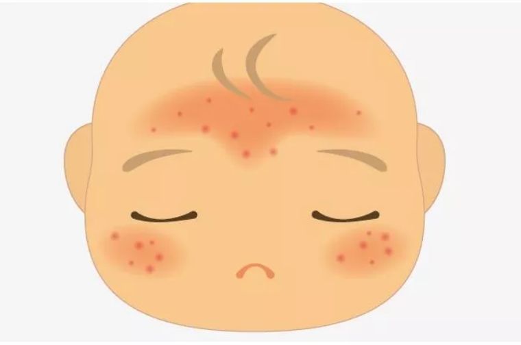 鹅蛋去胎毒和鹅肉去胎毒,胎毒是什么如何去胎毒