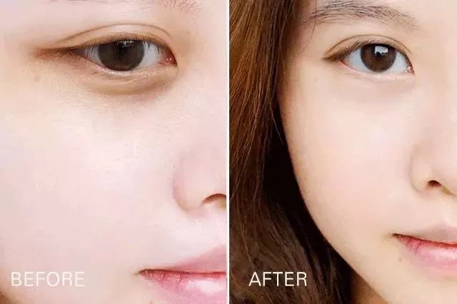 眼部最近出现了细纹怎么办,眼部细纹突然多