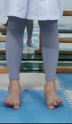 扁平足的锻炼矫正方法,10岁小孩扁平足的矫正方法