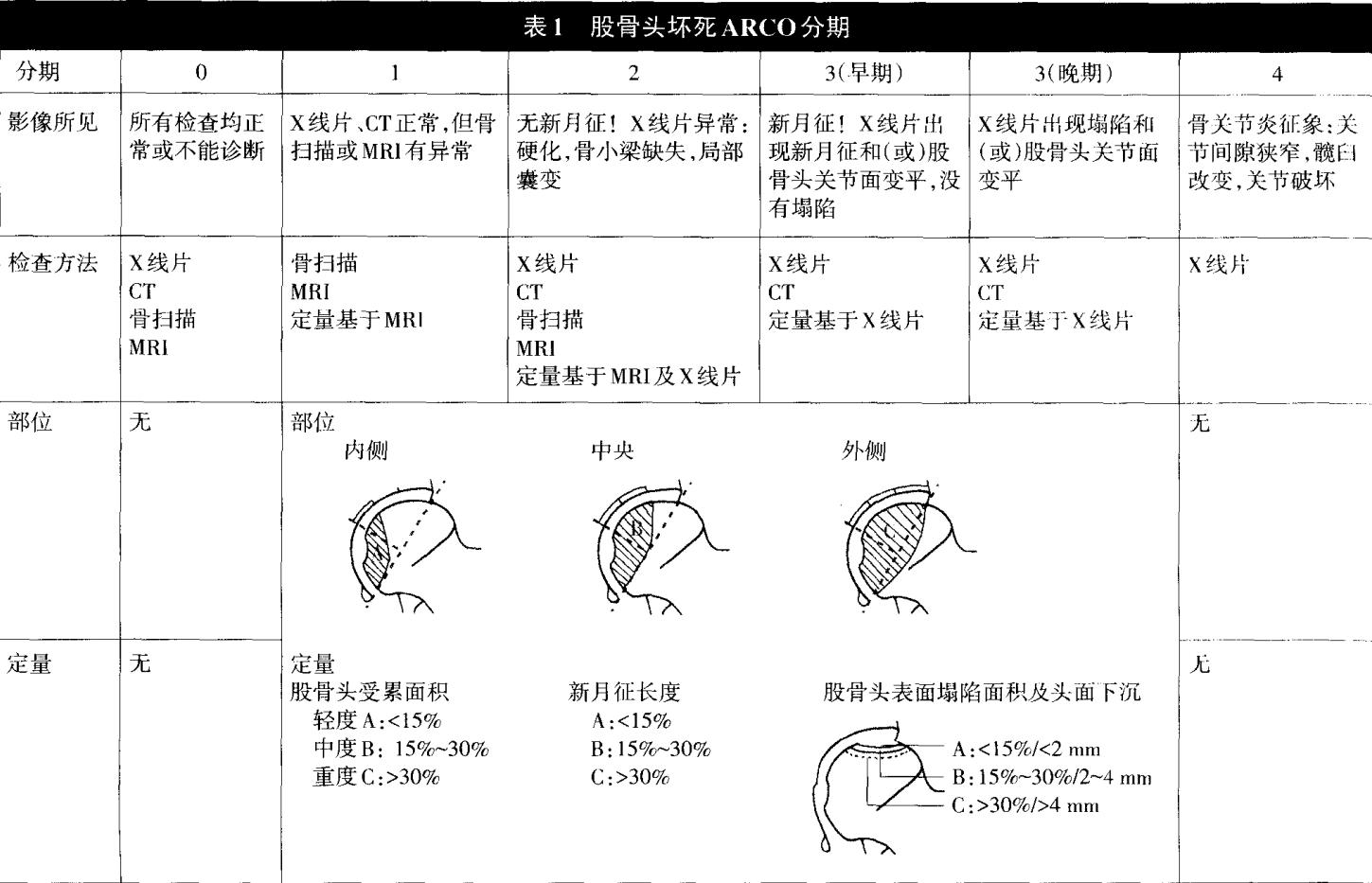什么是股骨头坏死原因,股骨头坏死和股骨头缺血性坏死
