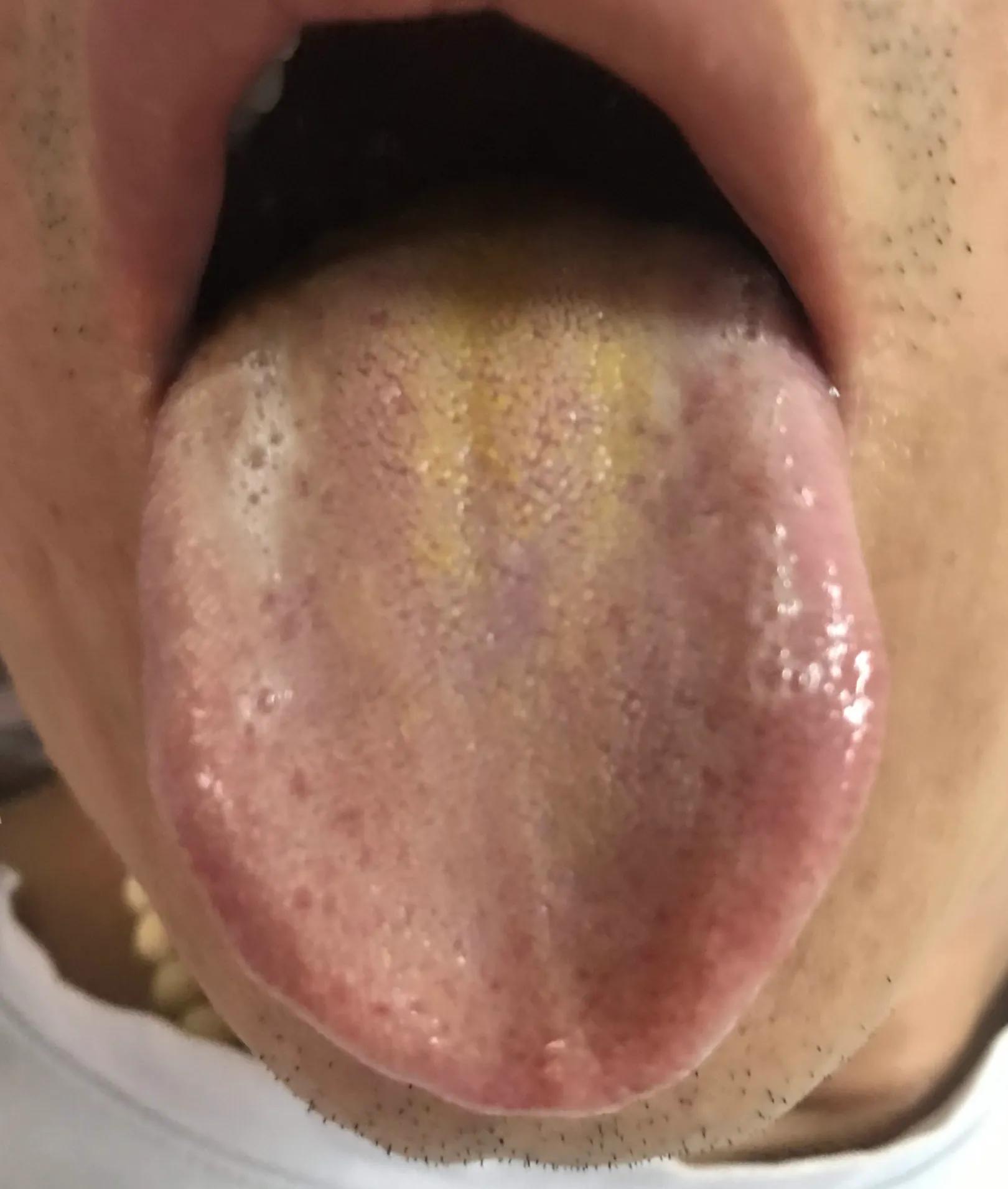 胸痛针灸哪些穴位可以治,董氏针灸治疗岔气胸痛