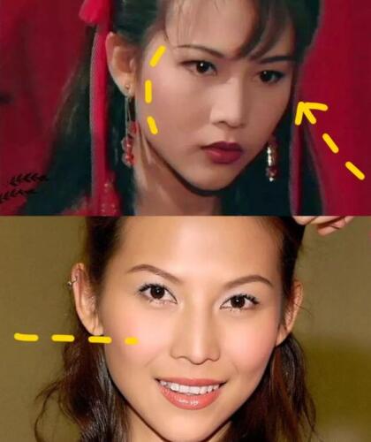 人中长颧骨高适合什么发型,人中长太阳穴凹陷