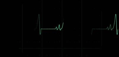 心突突突跳是怎么回事如何治疗,老是心慌跟熬夜有关系吗