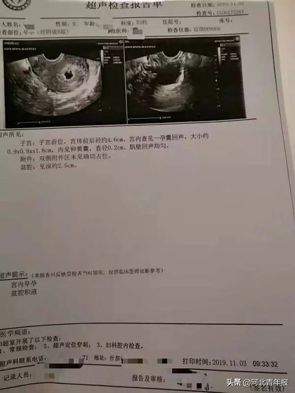 男子做绝育还能挽回吗,男子做了绝育手术