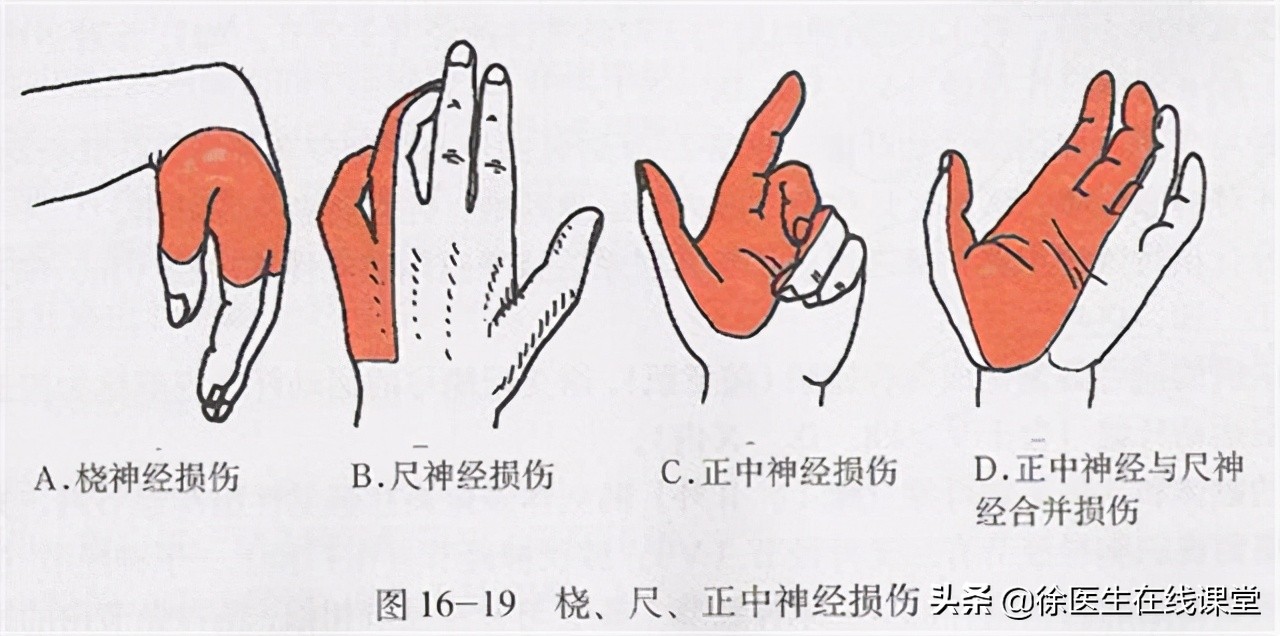 甲钴胺能修复大脑中枢神经吗,维生素b12和甲钴胺哪个修复神经好