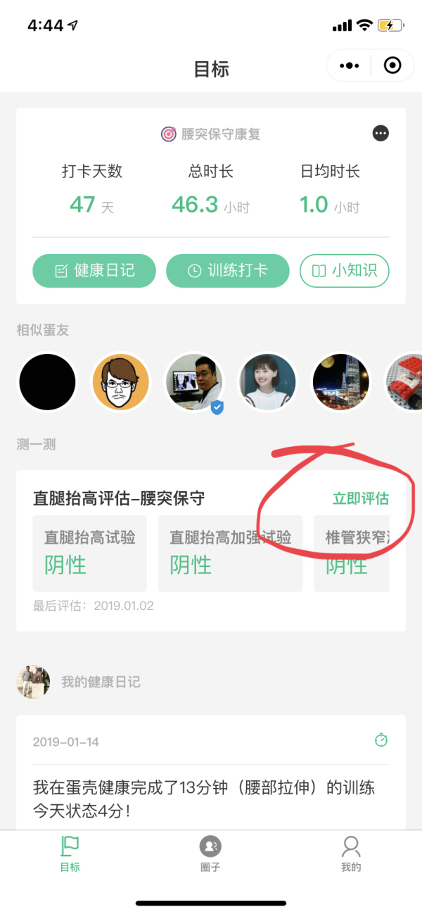 压到坐骨神经怎么缓解,坐骨神经痛吊单杠缓解